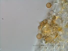  uredinium and urediniospores of  P. paullua 
